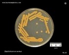 s.aureus on brain heart agar